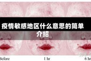 疫情敏感地区什么意思的简单介绍
