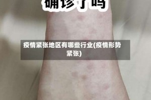 疫情紧张地区有哪些行业(疫情形势紧张)