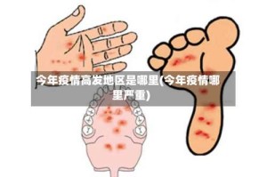 今年疫情高发地区是哪里(今年疫情哪里严重)