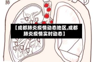 【成都肺炎疫情动态地区,成都肺炎疫情实时动态】