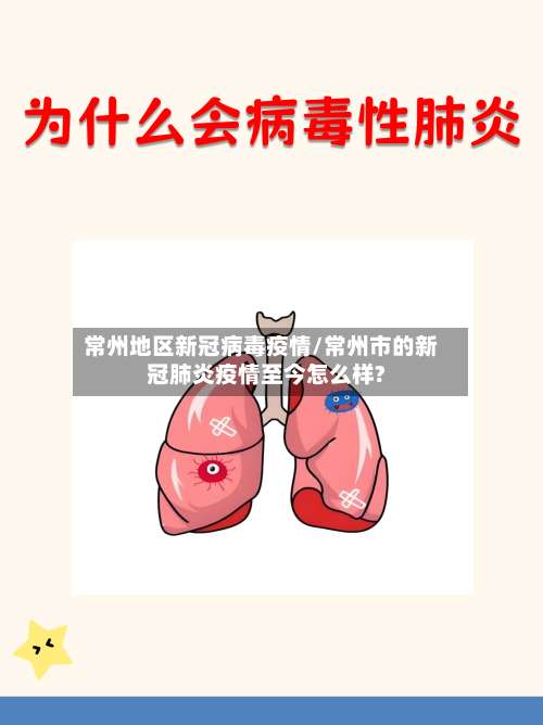 常州地区新冠病毒疫情/常州市的新冠肺炎疫情至今怎么样?-第3张图片