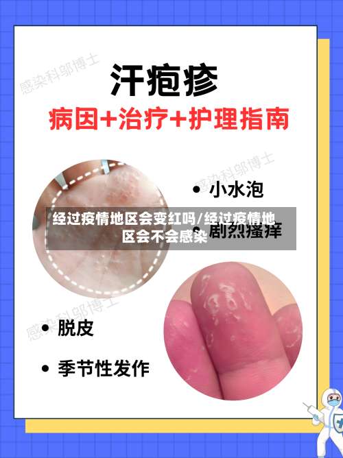 经过疫情地区会变红吗/经过疫情地区会不会感染-第2张图片