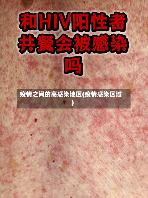 疫情之间的高感染地区(疫情感染区域)-第2张图片