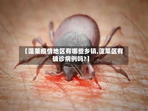 【蓬莱疫情地区有哪些乡镇,蓬莱区有确诊病例吗?】-第2张图片