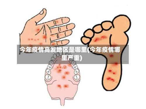 今年疫情高发地区是哪里(今年疫情哪里严重)-第1张图片
