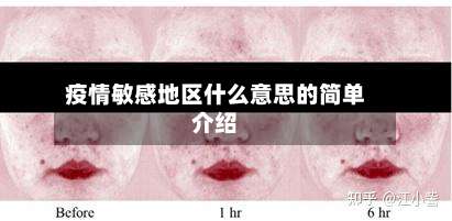 疫情敏感地区什么意思的简单介绍-第1张图片