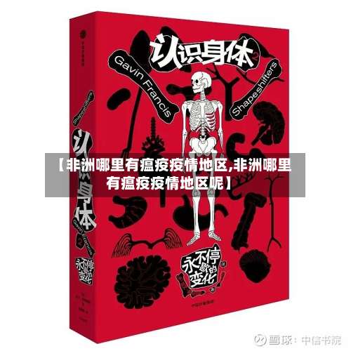 【非洲哪里有瘟疫疫情地区,非洲哪里有瘟疫疫情地区呢】-第3张图片