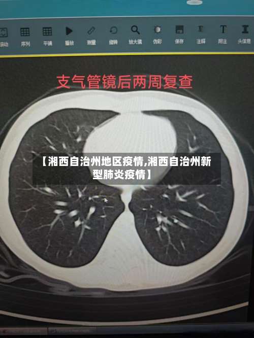 【湘西自治州地区疫情,湘西自治州新型肺炎疫情】-第1张图片