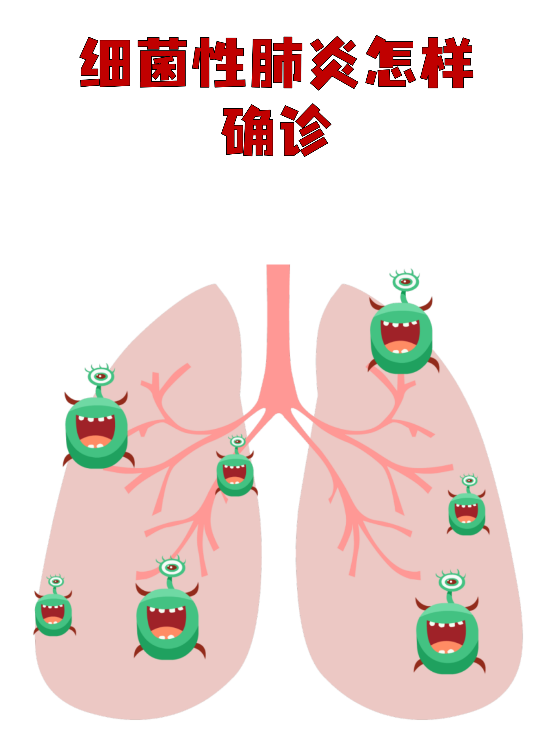 「西安确诊新型肺炎」〃西安发现新型肺炎-第1张图片